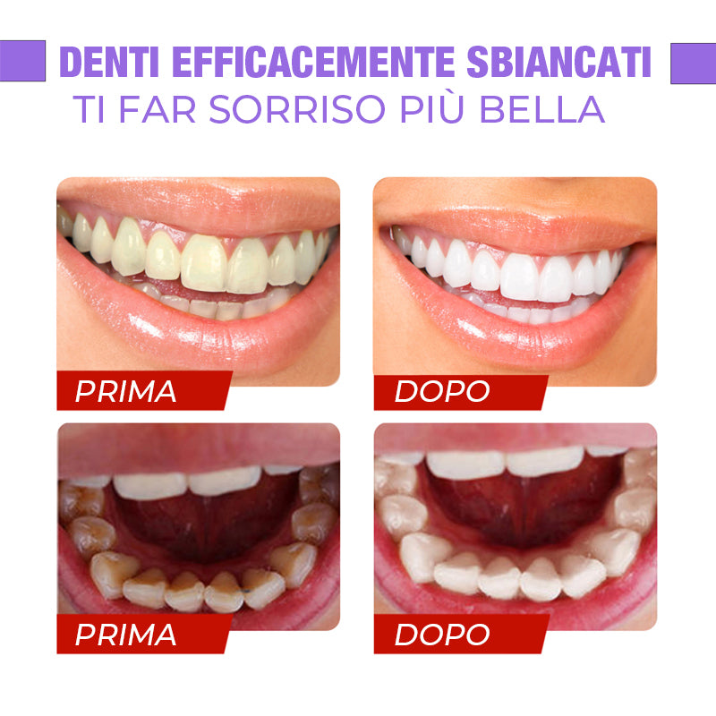 Correttore Di Colore Dentale